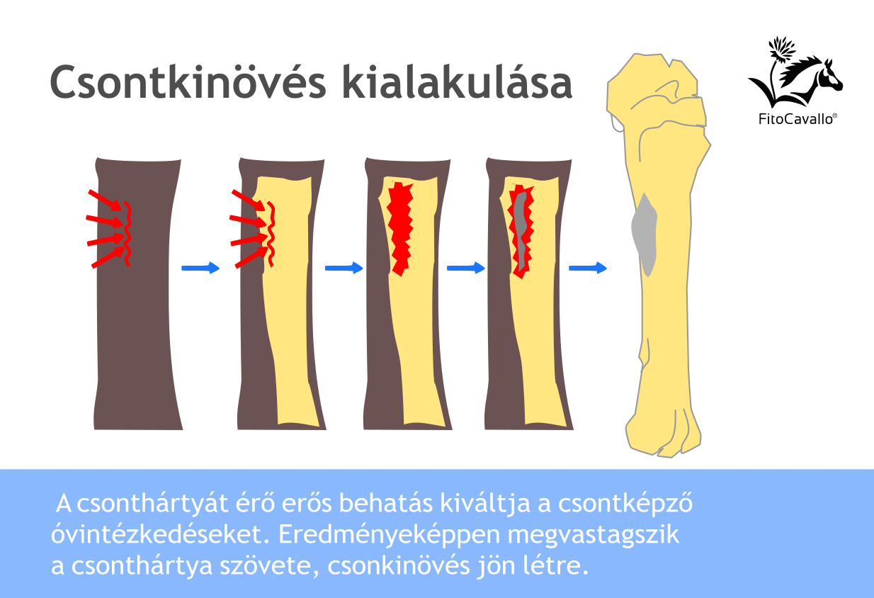 Csontkin v s T netek Hajlamos t T nyez k Csontkin v s T netek Hajlamos t T nyez k